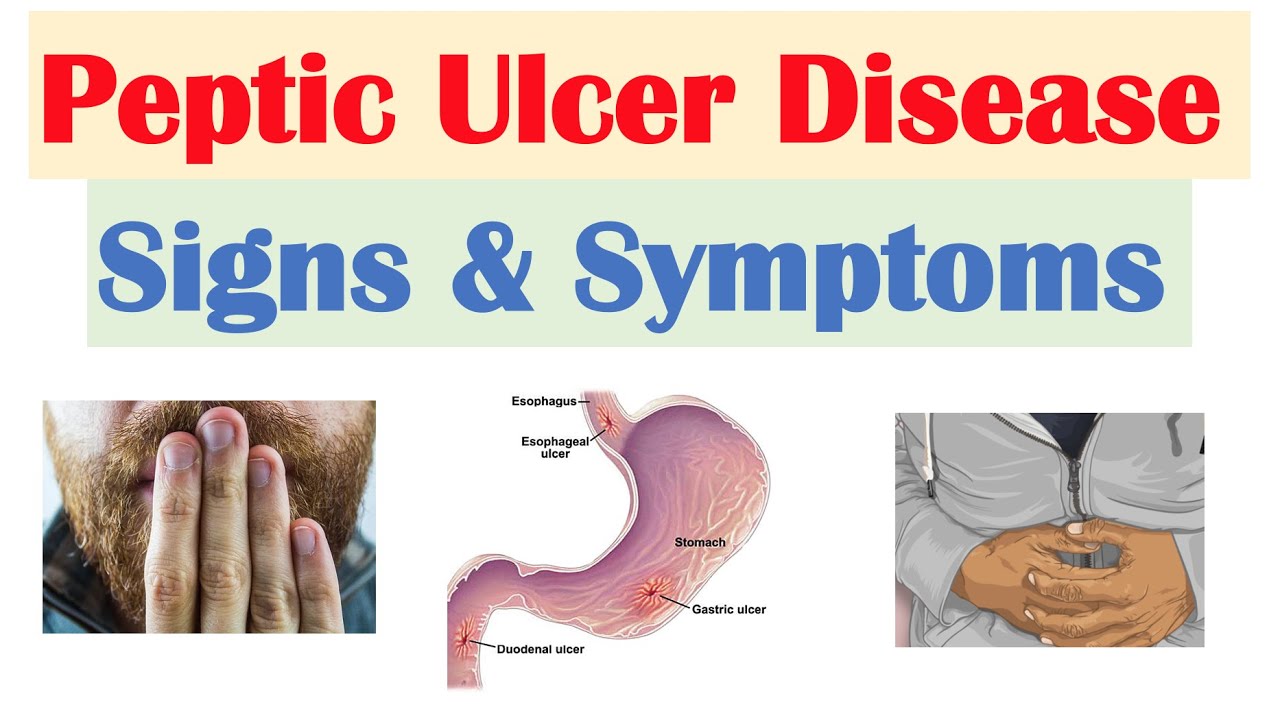 gastric and peptic disease